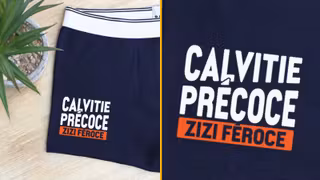 CALVITIE-PRECOCE-ZIZI-FEROCE