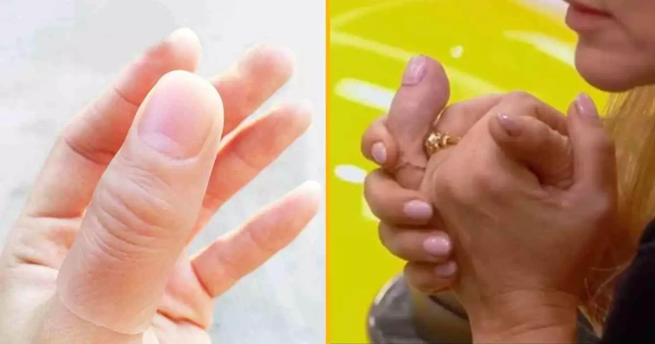 gros-pouce-plastique