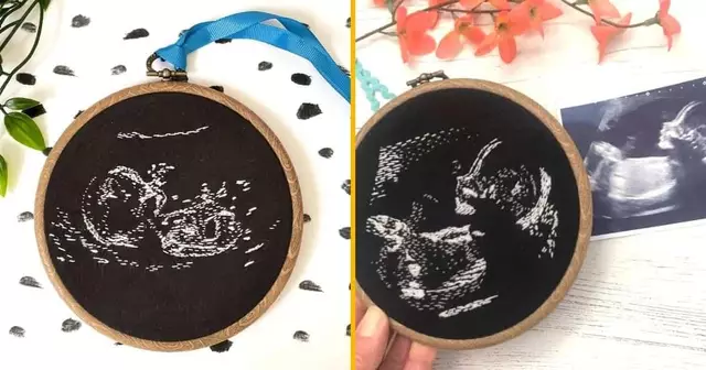 ecographie-brode-personnalisee