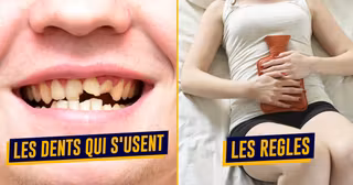 top defauts corps humain