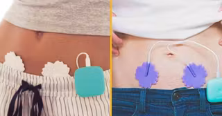 des-petites-electrodes-pour-attenuer-les-douleurs-menstruelles