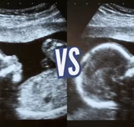 battle-347554-1420221450