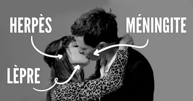 une_bisou_maladie_degueu_herpes