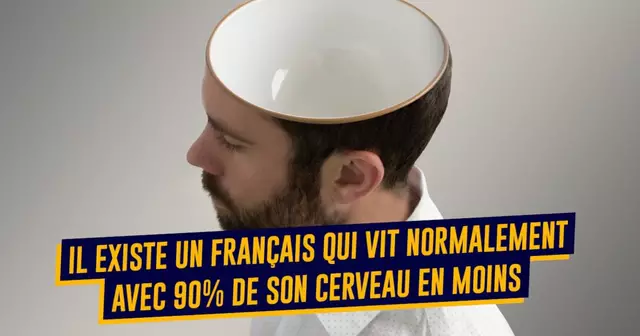 top cerveau