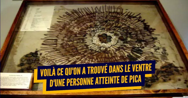 une_tocs_alimentaires