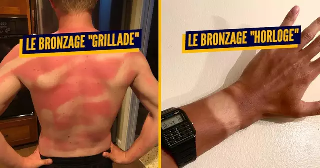 bronzage