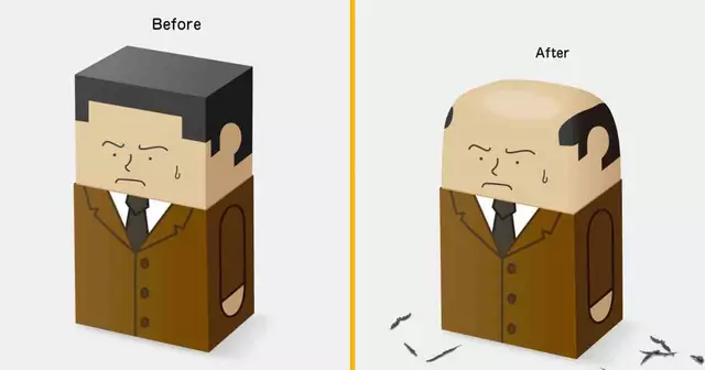 gomme-chauve-limage-calvitie-naissance