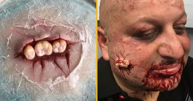 prothese-dents-sortent