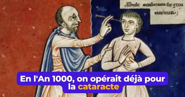 cataracte