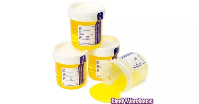 bonbon-echantillon-urine