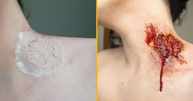 prothese-morsure-zombie