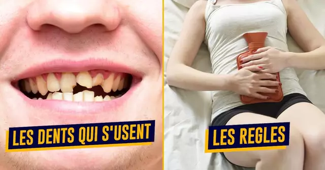 top defauts corps humain