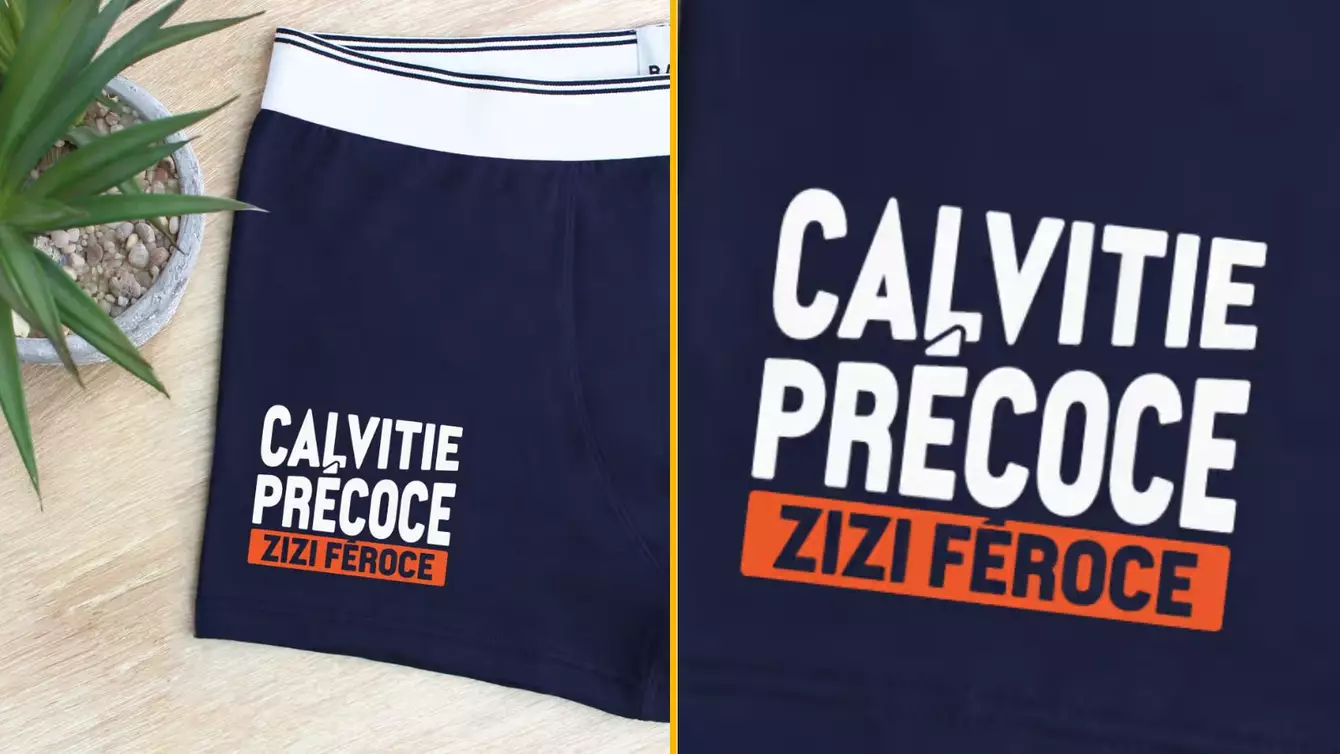 CALVITIE-PRECOCE-ZIZI-FEROCE