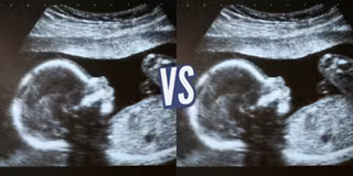 battle-347554-1420221450