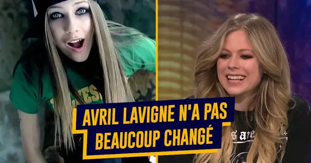 top stars avant apres